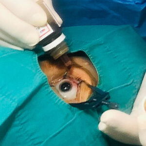 Povidon jod &#8211; prevencija tokom oftalmoloških intervencija, dr Sandra Jovanović