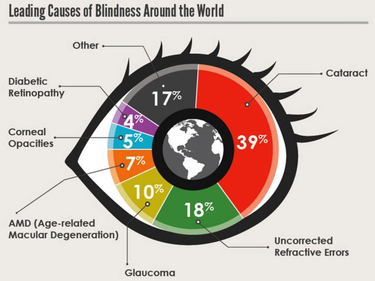 The most common causes of blindness and low vision