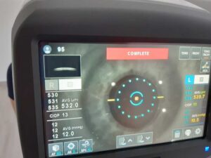 How to measure the value of intraocular pressure as accurately as possible?, dr Sandra Jovanović